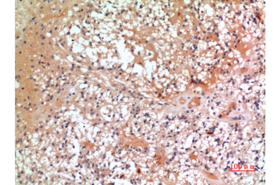 Immunohistochemistry - Anti-CMTM6 Antibody (C30731) - Antibodies.com