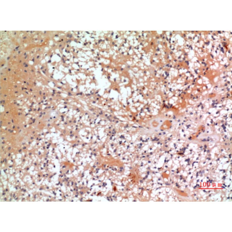 Immunohistochemistry - Anti-CMTM6 Antibody (C30731) - Antibodies.com