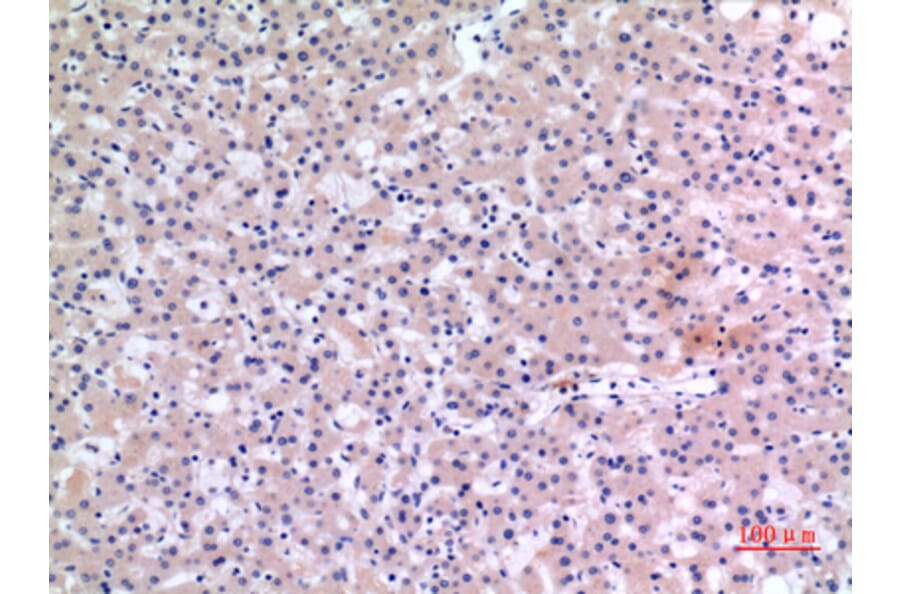 Immunohistochemistry - Anti-CMTM6 Antibody (C30731) - Antibodies.com