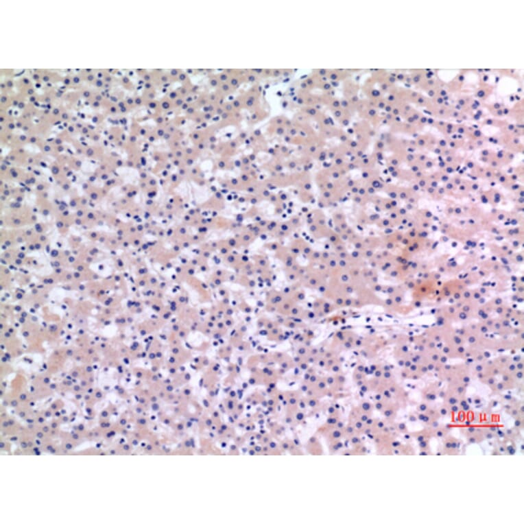 Immunohistochemistry - Anti-CMTM6 Antibody (C30731) - Antibodies.com