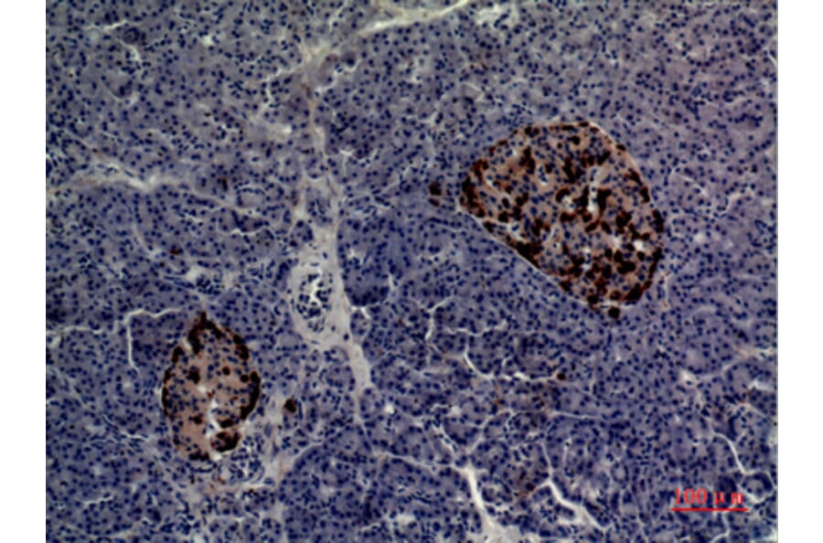Immunohistochemistry - Anti-CMTM5 Antibody (C30666) - Antibodies.com