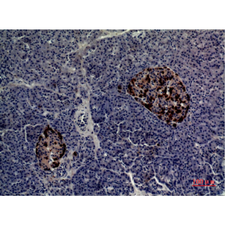 Immunohistochemistry - Anti-CMTM5 Antibody (C30666) - Antibodies.com