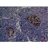 Immunohistochemistry - Anti-CMTM5 Antibody (C30666) - Antibodies.com