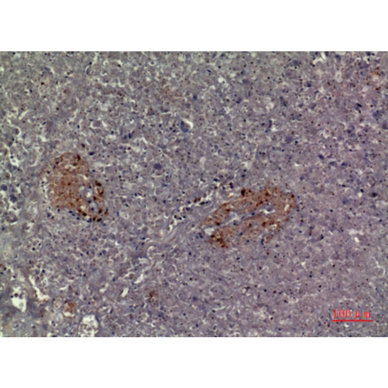 Immunohistochemistry - Anti-CMTM5 Antibody (C30666) - Antibodies.com