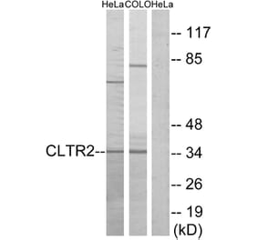 Western Blot - Anti-CLTR2 Antibody (G225) - Antibodies.com