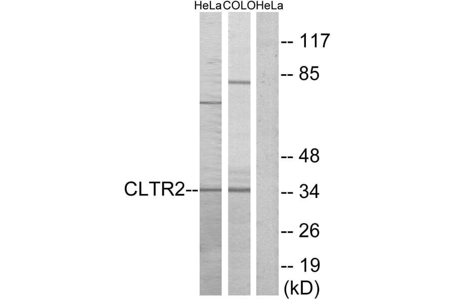 Western Blot - Anti-CLTR2 Antibody (G225) - Antibodies.com