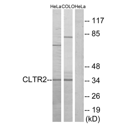 Western Blot - Anti-CLTR2 Antibody (G225) - Antibodies.com