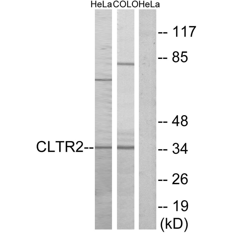 Western Blot - Anti-CLTR2 Antibody (G225) - Antibodies.com