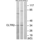 Western Blot - Anti-CLTR2 Antibody (G225) - Antibodies.com