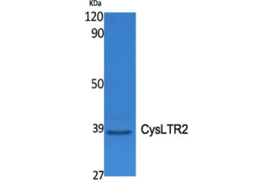 Western Blot - Anti-CLTR2 Antibody (G225) - Antibodies.com