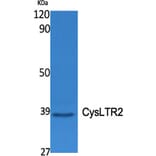 Western Blot - Anti-CLTR2 Antibody (G225) - Antibodies.com