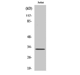 Western Blot - Anti-CLM-1 Antibody (C21312) - Antibodies.com