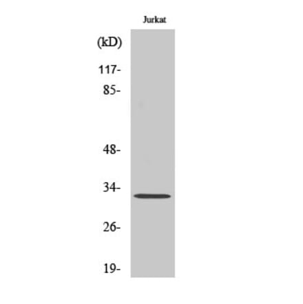 Western Blot - Anti-CLM-1 Antibody (C21312) - Antibodies.com