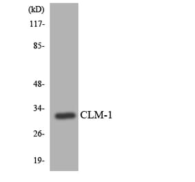 Western Blot - Anti-CLM-1 Antibody (R12-2631) - Antibodies.com