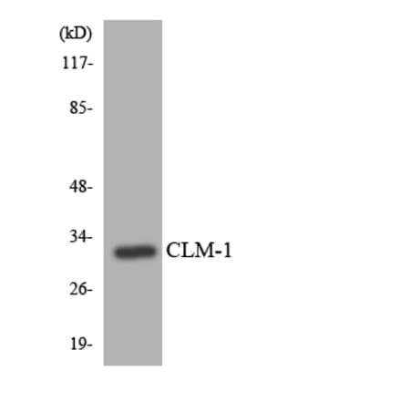 Western Blot - Anti-CLM-1 Antibody (R12-2631) - Antibodies.com