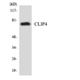 Western Blot - Anti-CLIP4 Antibody (R12-2629) - Antibodies.com