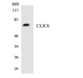 Western Blot - Anti-CLIC6 Antibody (R12-2628) - Antibodies.com