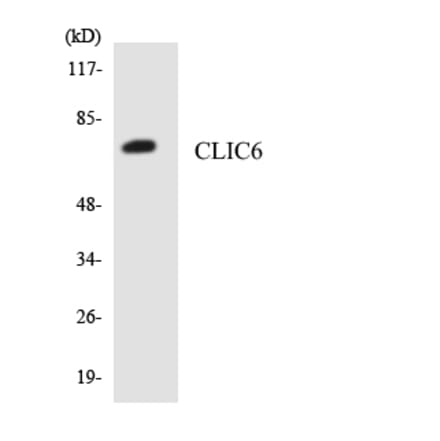 Western Blot - Anti-CLIC6 Antibody (R12-2628) - Antibodies.com