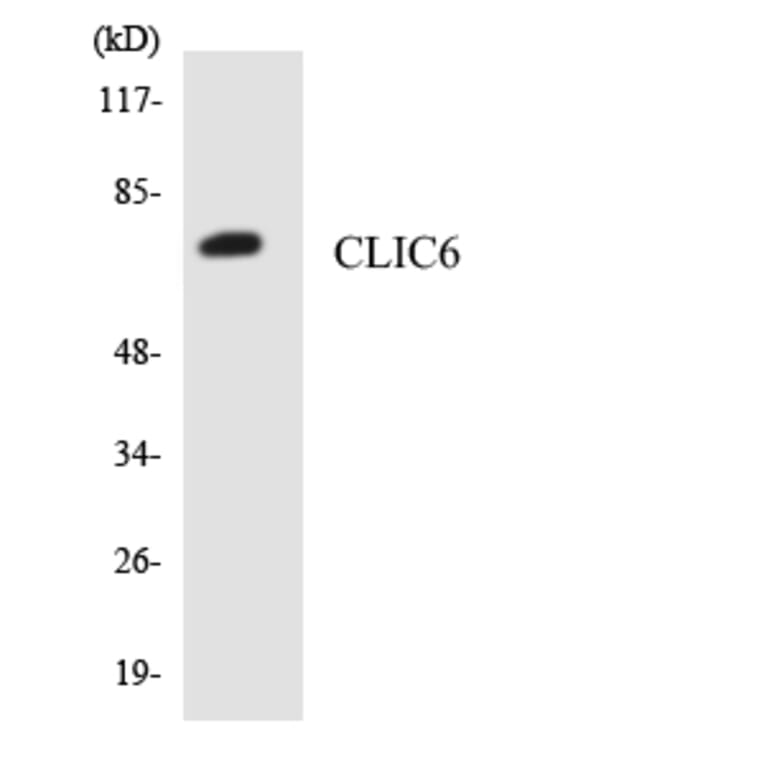 Western Blot - Anti-CLIC6 Antibody (R12-2628) - Antibodies.com