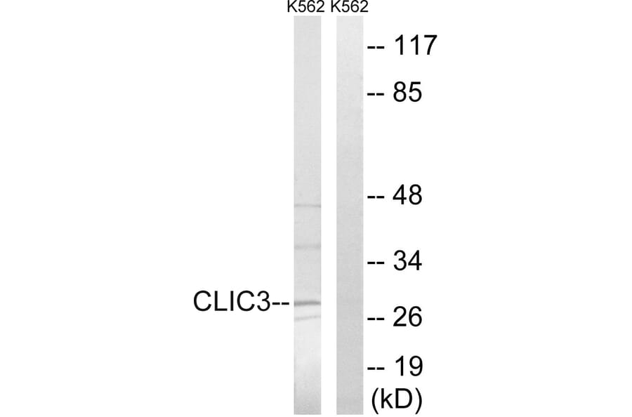 Western Blot - Anti-CLIC3 Antibody (C15089) - Antibodies.com