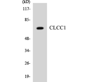 Western Blot - Anti-CLCC1 Antibody (R12-2624) - Antibodies.com