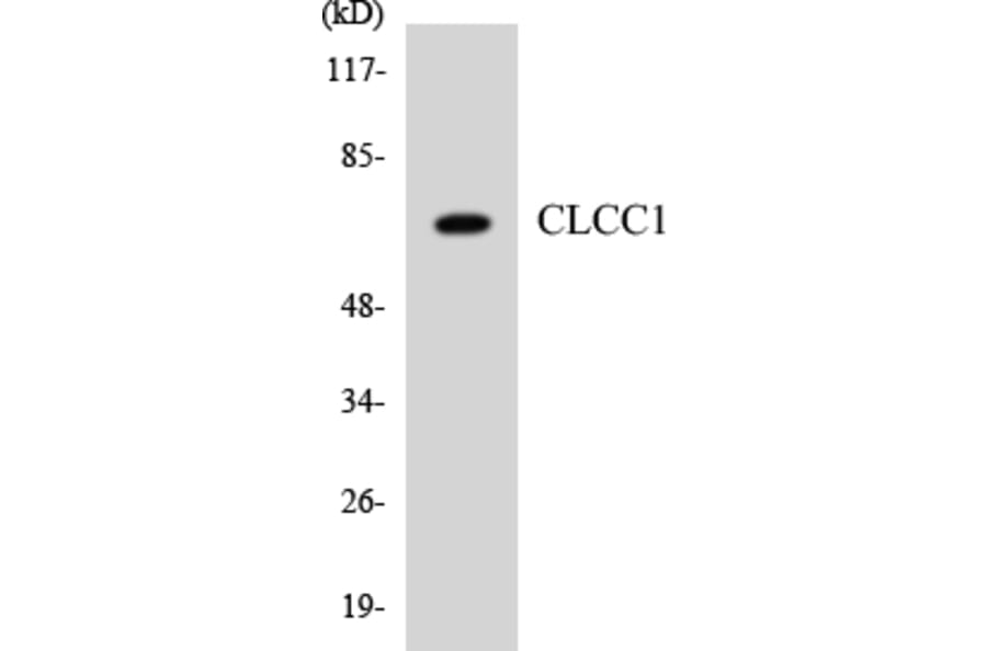 Western Blot - Anti-CLCC1 Antibody (R12-2624) - Antibodies.com