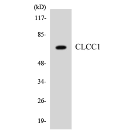 Western Blot - Anti-CLCC1 Antibody (R12-2624) - Antibodies.com