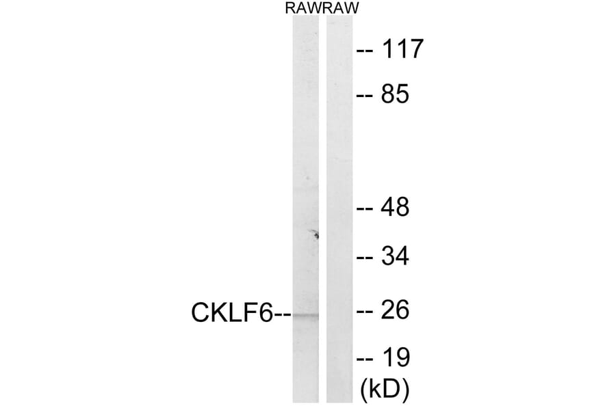 Western Blot - Anti-CKLF6 Antibody (C15136) - Antibodies.com