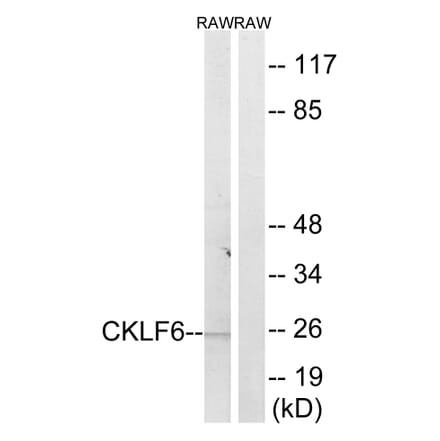 Western Blot - Anti-CKLF6 Antibody (C15136) - Antibodies.com