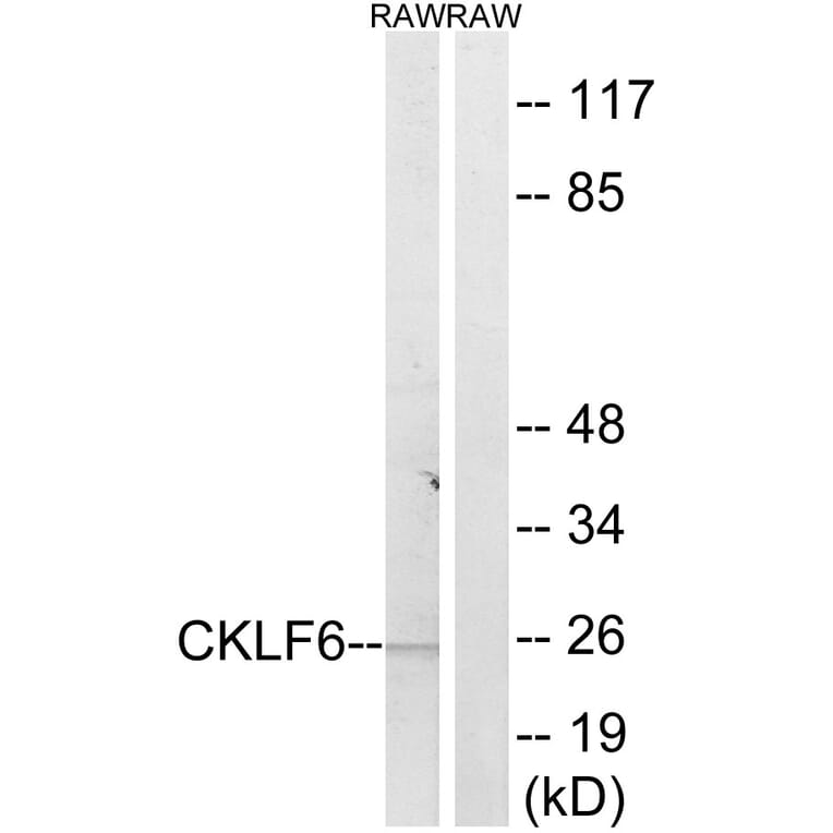 Western Blot - Anti-CKLF6 Antibody (C15136) - Antibodies.com