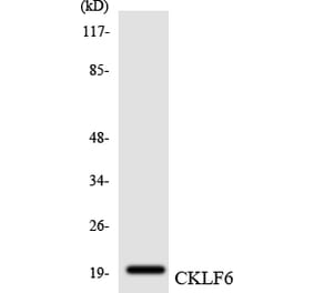Western Blot - Anti-CKLF6 Antibody (R12-2623) - Antibodies.com