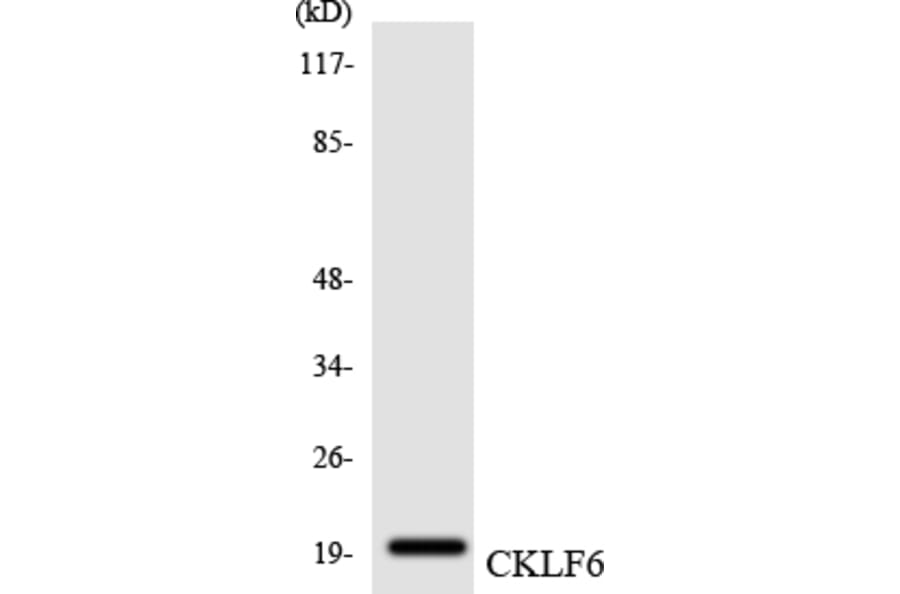 Western Blot - Anti-CKLF6 Antibody (R12-2623) - Antibodies.com
