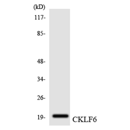Western Blot - Anti-CKLF6 Antibody (R12-2623) - Antibodies.com