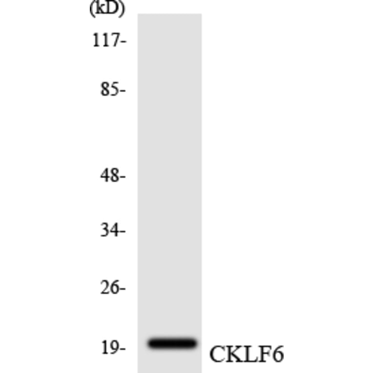 Western Blot - Anti-CKLF6 Antibody (R12-2623) - Antibodies.com