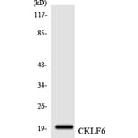 Western Blot - Anti-CKLF6 Antibody (R12-2623) - Antibodies.com