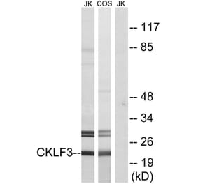 Western Blot - Anti-CKLF3 Antibody (C15133) - Antibodies.com