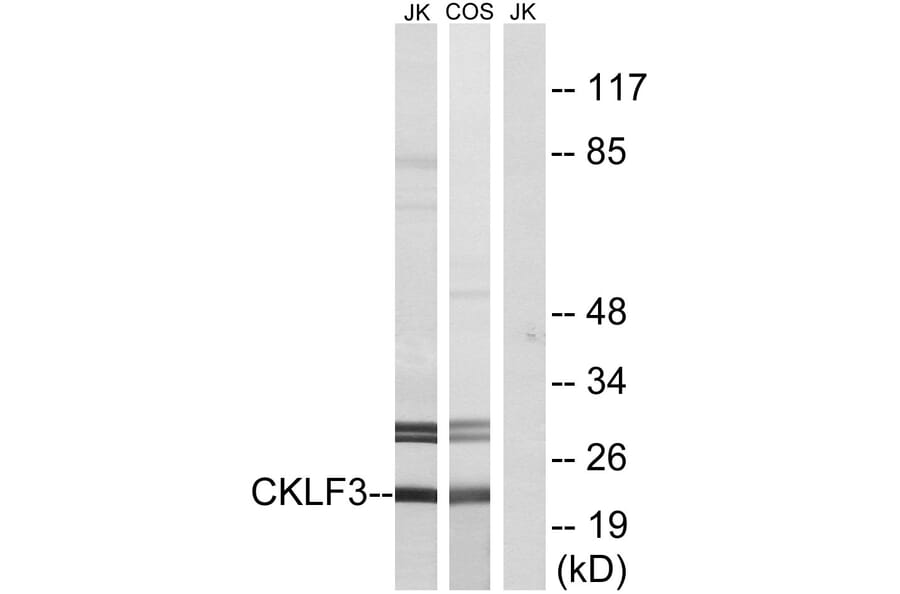 Western Blot - Anti-CKLF3 Antibody (C15133) - Antibodies.com
