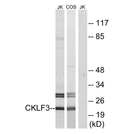 Western Blot - Anti-CKLF3 Antibody (C15133) - Antibodies.com