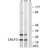Western Blot - Anti-CKLF3 Antibody (C15133) - Antibodies.com