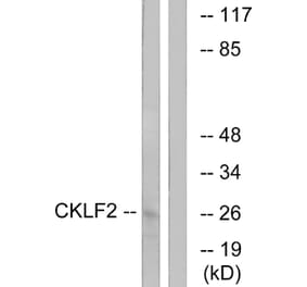 Western Blot - Anti-CKLF2 Antibody (C15132) - Antibodies.com