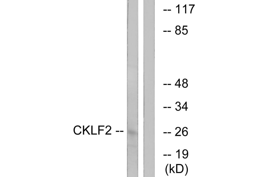 Western Blot - Anti-CKLF2 Antibody (C15132) - Antibodies.com