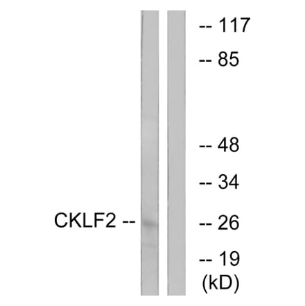 Western Blot - Anti-CKLF2 Antibody (C15132) - Antibodies.com