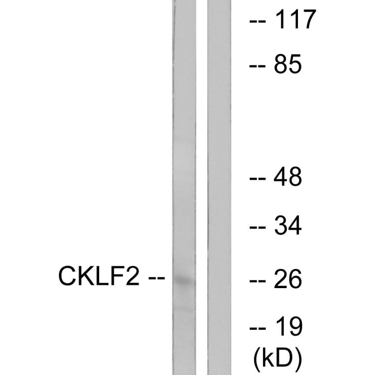 Western Blot - Anti-CKLF2 Antibody (C15132) - Antibodies.com
