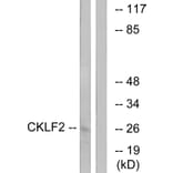 Western Blot - Anti-CKLF2 Antibody (C15132) - Antibodies.com