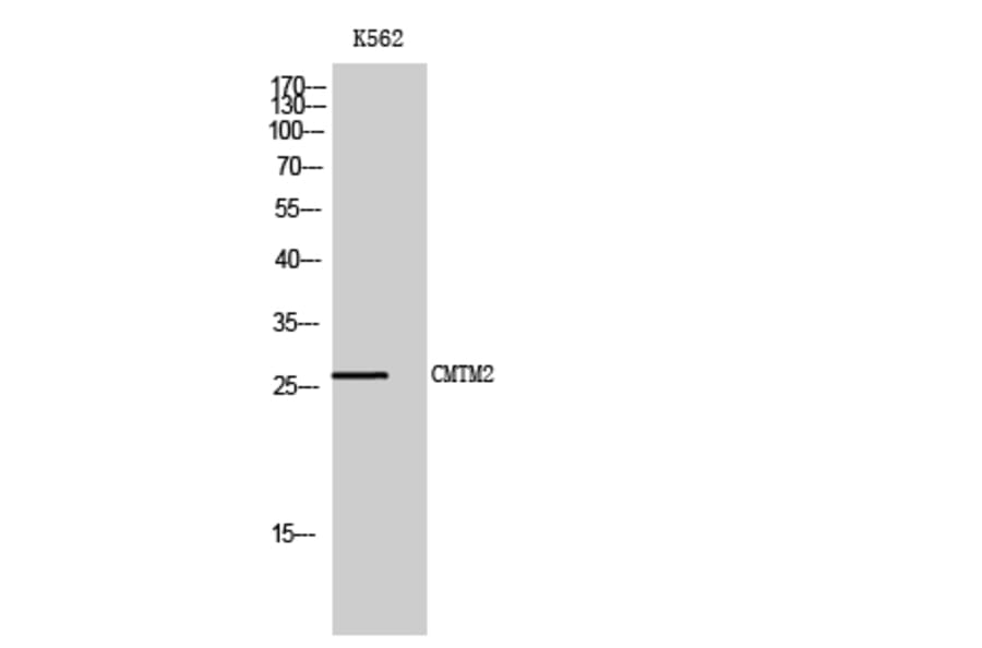 Western Blot - Anti-CKLF2 Antibody (C15132) - Antibodies.com