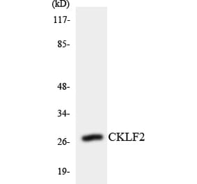 Western Blot - Anti-CKLF2 Antibody (R12-2622) - Antibodies.com