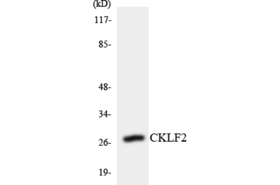 Western Blot - Anti-CKLF2 Antibody (R12-2622) - Antibodies.com