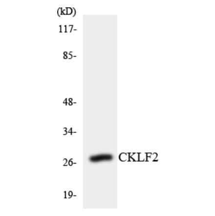 Western Blot - Anti-CKLF2 Antibody (R12-2622) - Antibodies.com