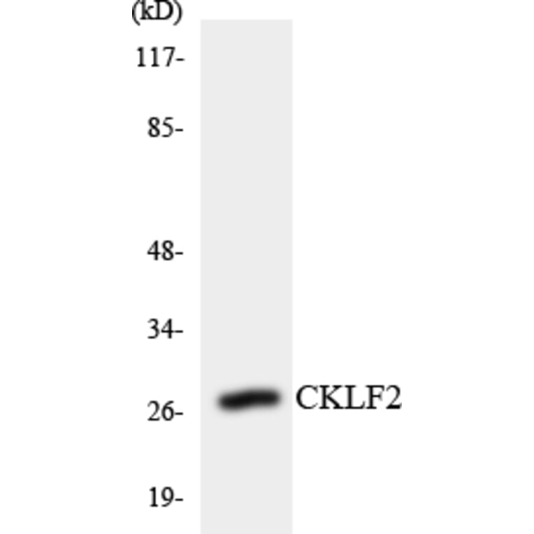 Western Blot - Anti-CKLF2 Antibody (R12-2622) - Antibodies.com