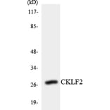Western Blot - Anti-CKLF2 Antibody (R12-2622) - Antibodies.com